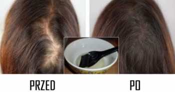 Domowy sposób na wypadające włosy – przepis na maseczkę