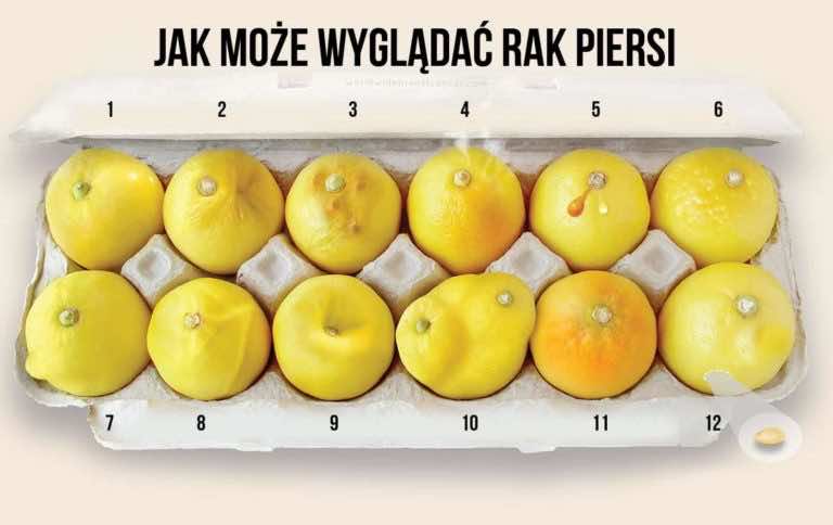 Zobacz na przykładzie cytryn jak może wyglądać rak piersi i wykryj go na czas