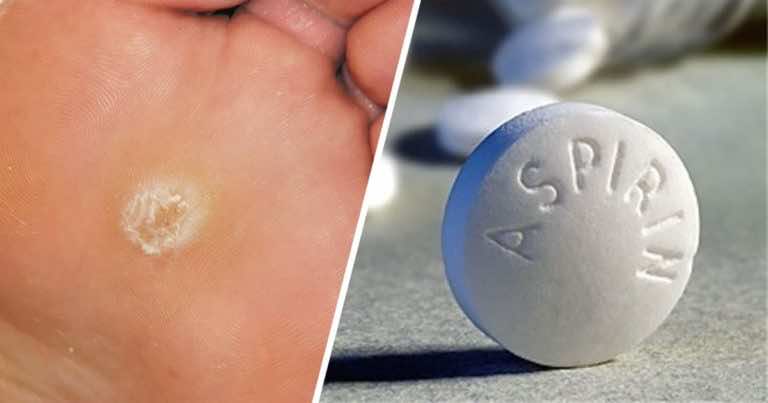 Aspiryna na twarde odciski na stopach