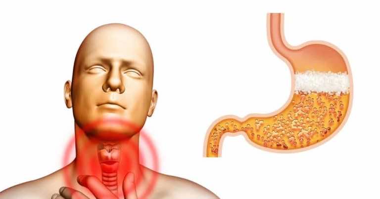 Domowy sposób na zgagę