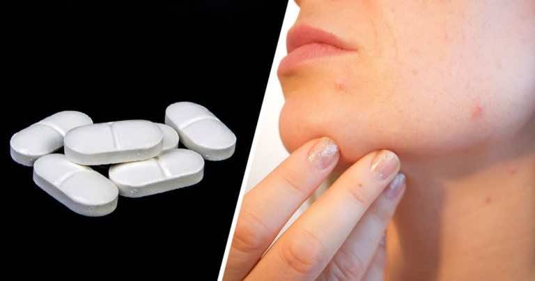 Paracetamol skuteczny nie tylko na ból. Zobacz jak jeszcze możesz go wykorzystać!