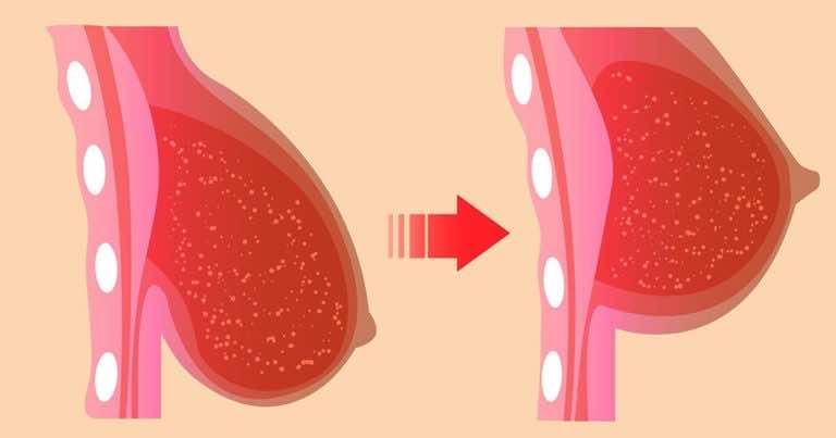 Skuteczne pozycje jogi, które poprawią kształt obwisłego biustu