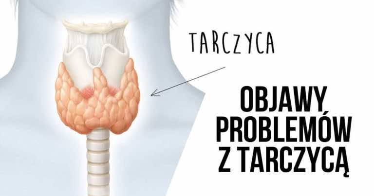 Oznaki, które może dawać Ci chora tarczyca