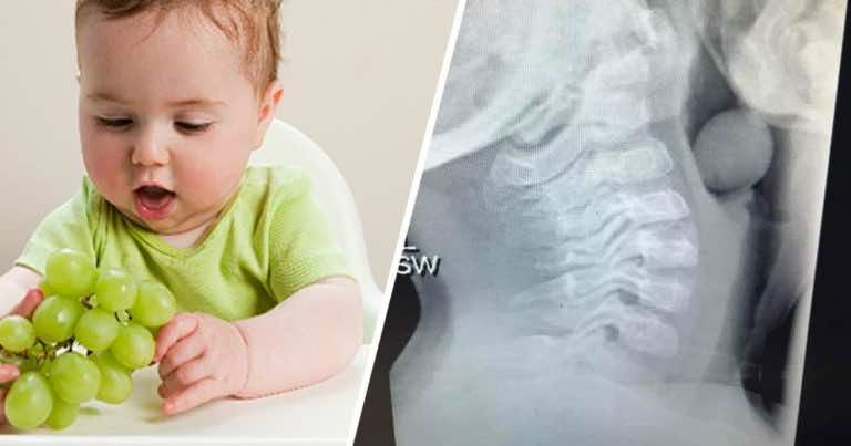 Winogrona prawie go zabiły. Uważaj na to dając dziecku przekąski z owoców!