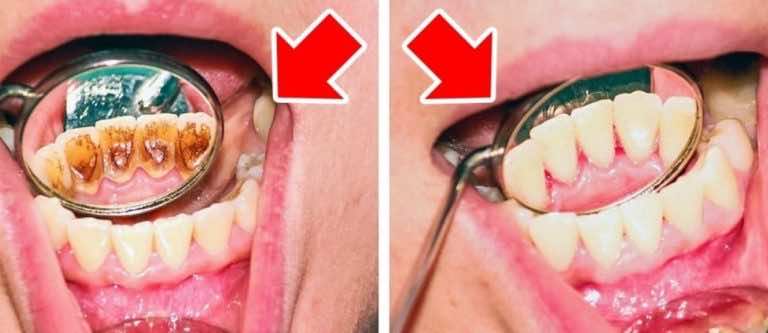 8 podstawowych błędów, które popełniamy dbając o nasze zęby