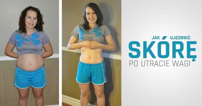 Sporo schudłaś i skóra stała się obwisła? Zobacz jak ją ujędrnić.