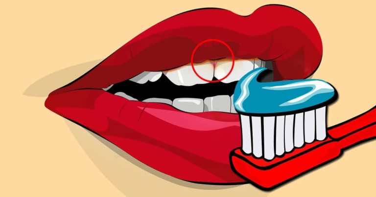 Używacie pasty z fluorem do mycia zębów? Powinniście przestać!