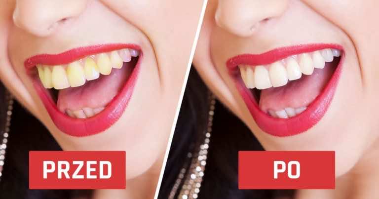 Kilka trików, dzięki którym Twój uśmiech będzie biały i piękny