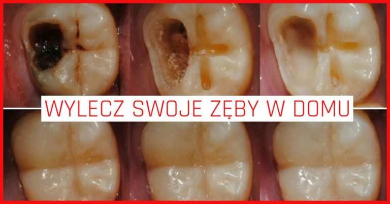 Masz problemy z zębami? Musisz wprowadzić tych 5 zmian!
