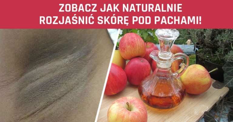 Chcesz rozjaśnić skórę pod pachami? Wykorzystaj ten naturalny sposób!