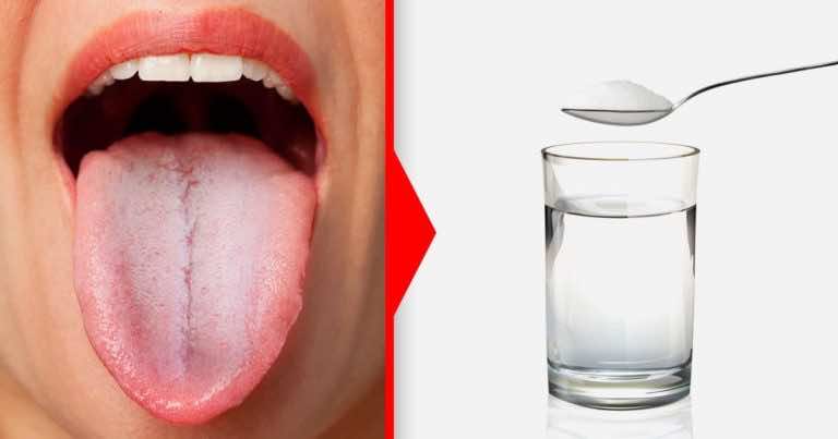 Twój język tak wygląda? Zobacz dlaczego i jak sobie z tym poradzić!