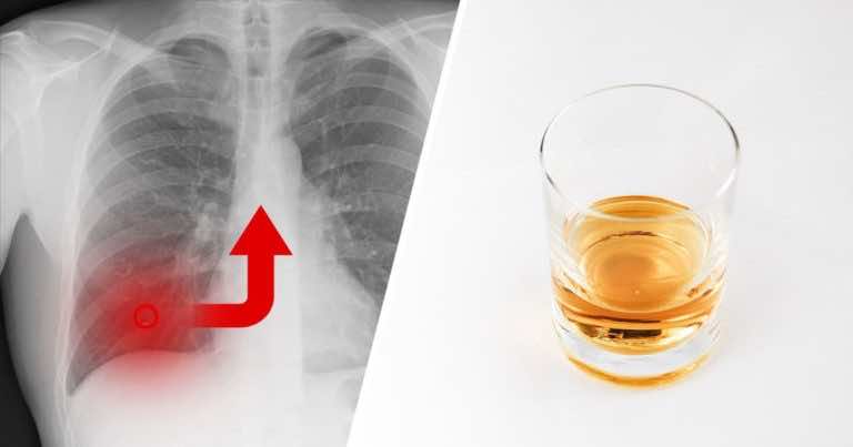 Flegma palacza – zobacz jak szybciej się jej pozbyć!