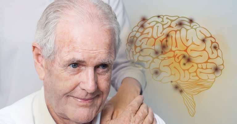 Naukowcy odkryli przyczyny wczesnego rozwoju demencji. Zacznij przeciwdziałać już dzisiaj!
