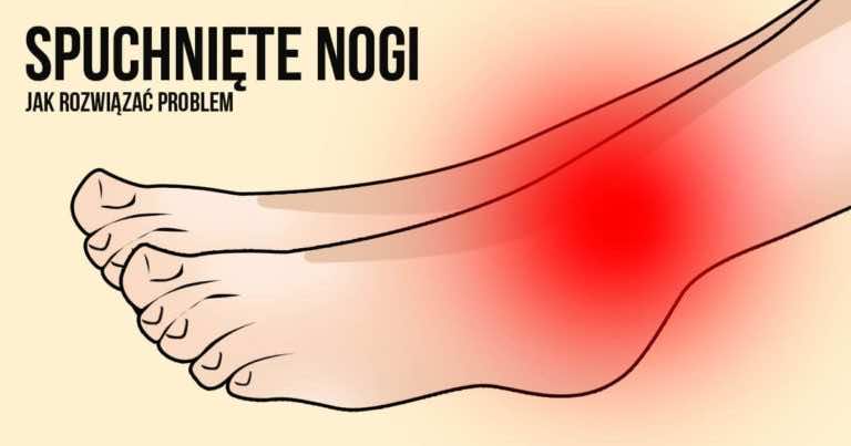 Stopy puchną nie tylko przez złe buty. Sprawdź prawdę i rozwiąż problem!