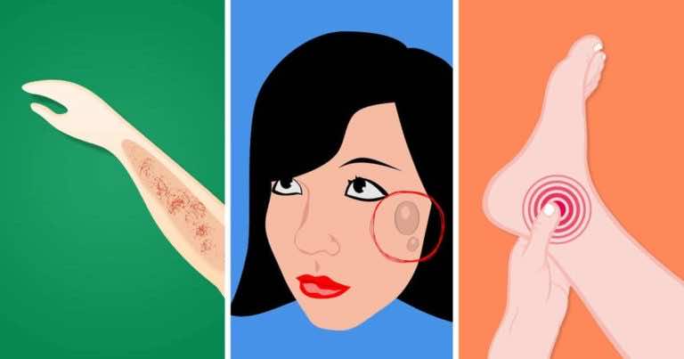 Niektóre objawy raka, które ludzie ignorują