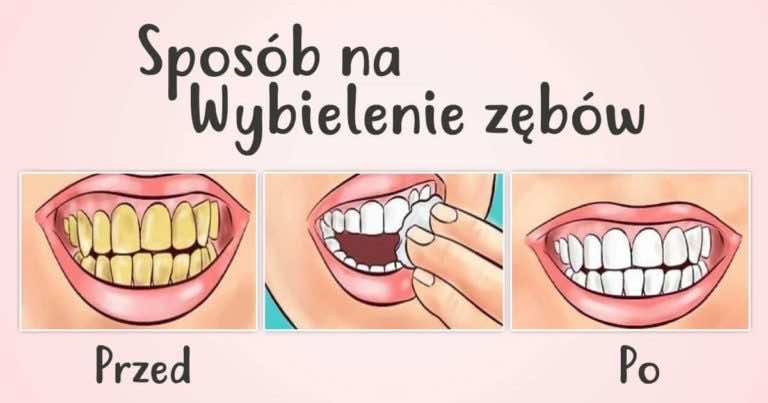 Masz dość ukrywania uśmiechu? Wypróbuj ten sposób na wybielenie zębów.
