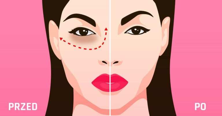 Jak usunąć cienie pod oczami? DOMOWY SPOSÓB!