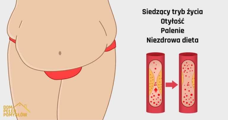 5 sygnałów ostrzegawczych, że Twoje arterie są zablokowane