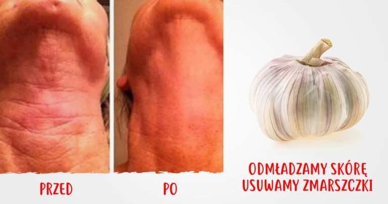 Zobacz jak za pomocą tego domowego środka odmłodziła szyję