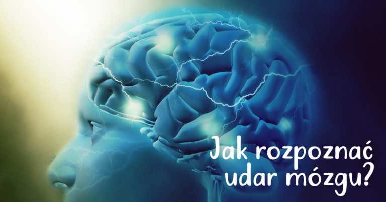 Jak rozpoznać udar mózgu?