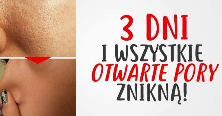 3 DNI i wszystkie otwarte pory znikną