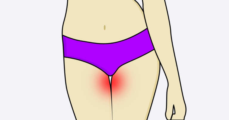 5 problemów, które każda z nas ma co lato. Jak je rozwiązać?