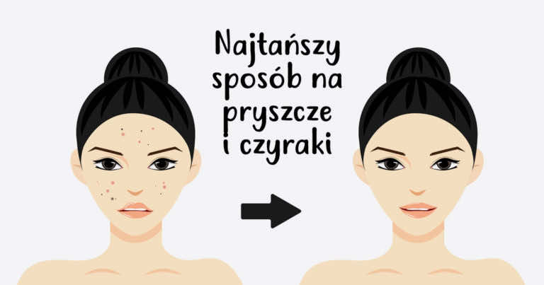 Najtańszy sposób na pryszcze i czyraki jaki dostaniesz w aptece