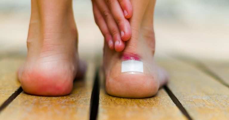 Obtarte pięty od butów – DOMOWE SPOSOBY