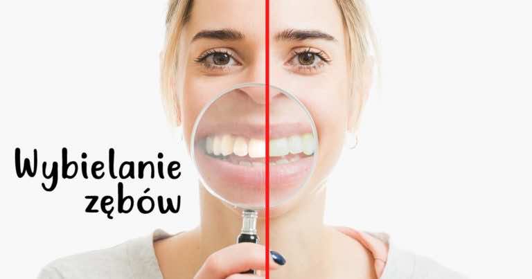 3 domowe sposoby na wybielenie zębów