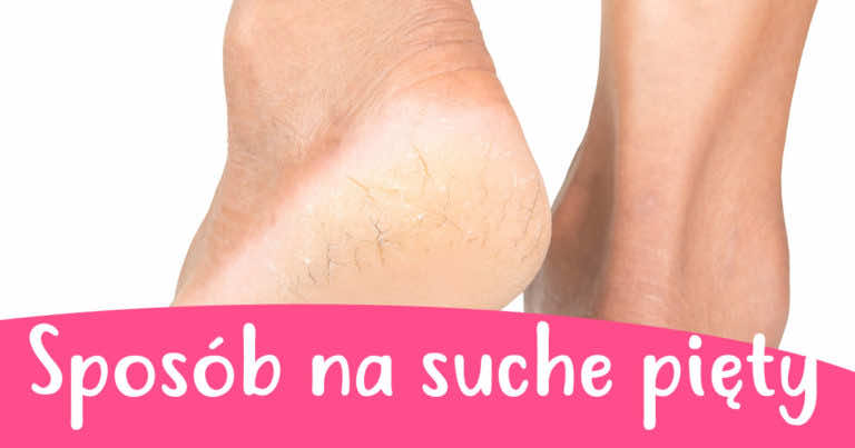 Świetny sposób na gładkie pięty, który musisz wykorzystać