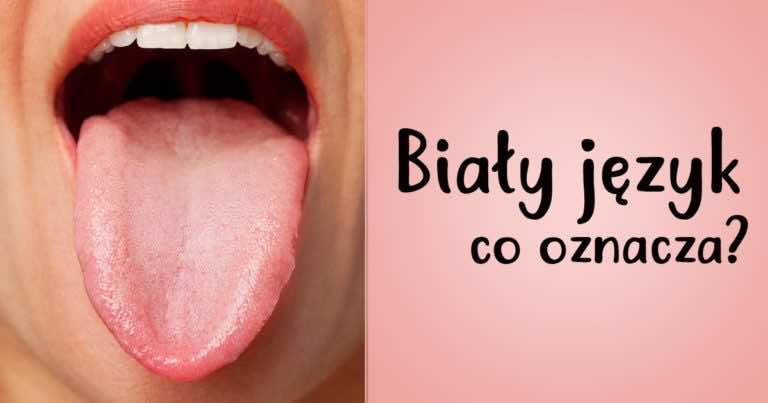 Mój język jest biały? Co to oznacza?