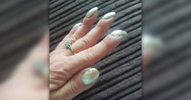 Ten kształt paznokci oznacza poważną chorobę!