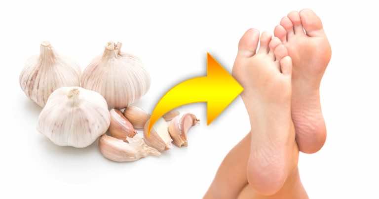 Zobacz, na jakie problemy pomaga moczenie stóp w wodzie z CZOSNKIEM