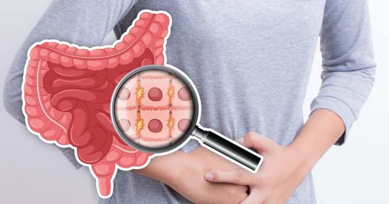 Ten koktajl usunie pasożyty z jelit!