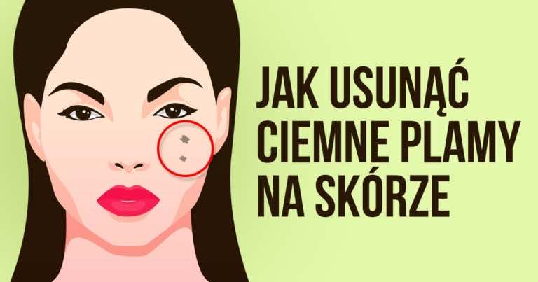 Ciemniejsze plamy na twarzy – 3 maseczki, które pomogą Ci je usunąć