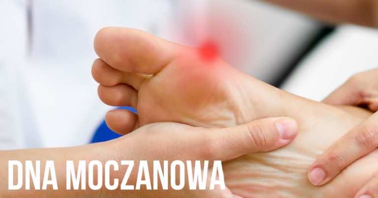Dna moczanowa, zobacz czy masz z nią problem i czego wtedy nie wolno jeść!