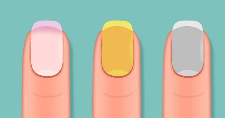 Zobacz co kolor paznokci może powiedzieć o Twoim zdrowiu
