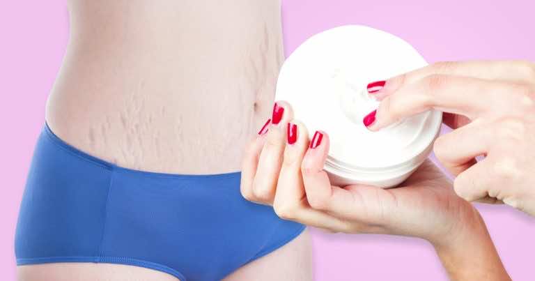 Przepis na domowy krem na rozstępy