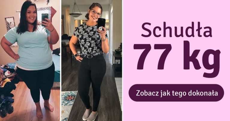 Schudła 77kg i chce udowodnić innym, że nic nie jest niemożliwe!