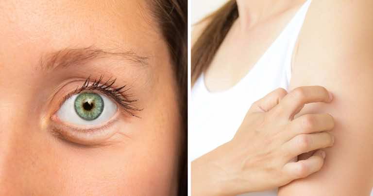 6 sygnałów, że w Twojej diecie jest za dużo cukru!