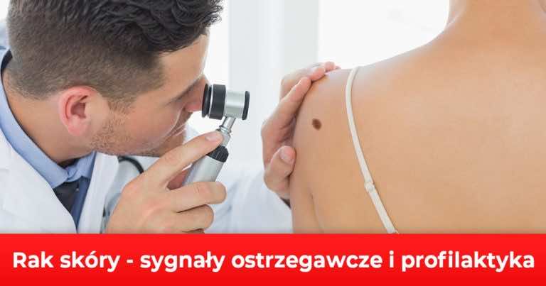 Rak skóry – sygnały ostrzegawcze i profilaktyka