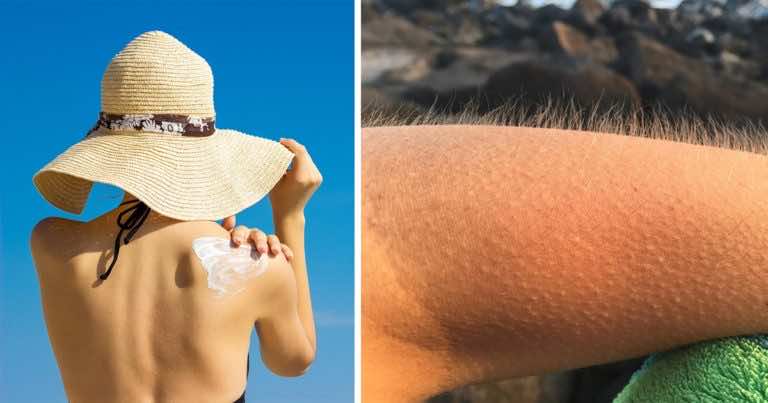 Jeśli podczas upałów dostaniesz gęsiej skórki to musisz o tym wiedzieć!