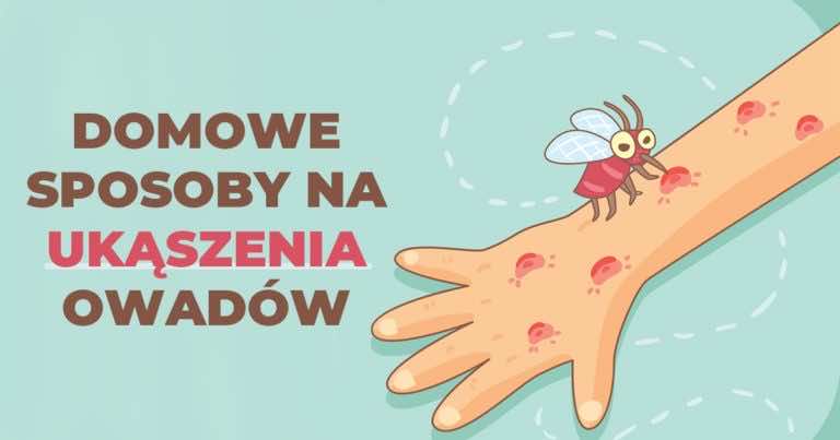 Domowe sposoby na ukąszenia owadów