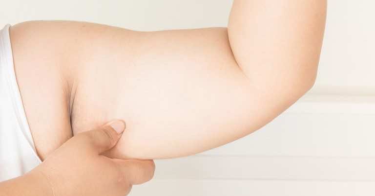 Czy można ujędrnić skórę zwiotczałą po utracie wagi?