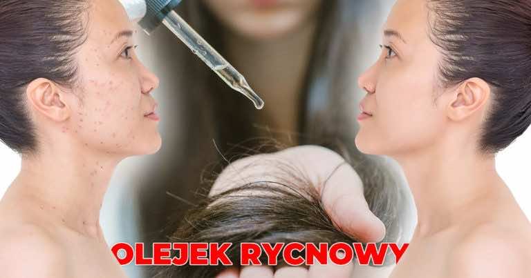 Olej rycynowy – kupisz go za 5 zł w aptece, a zastąpi Ci wiele kosmetyków!