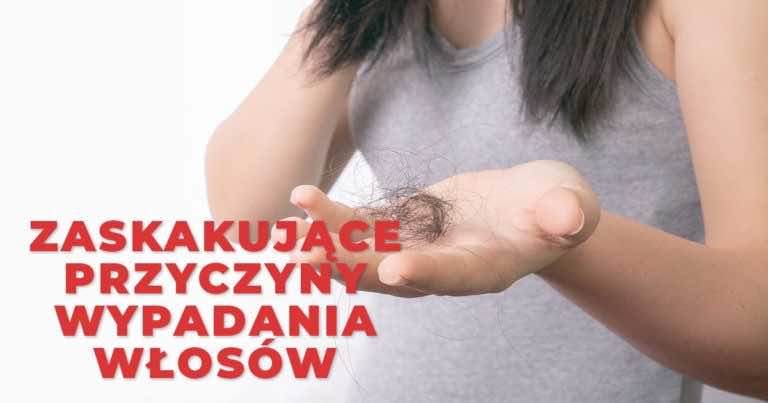 4 zaskakujące przyczyny wypadania włosów, na które byś nie wpadła
