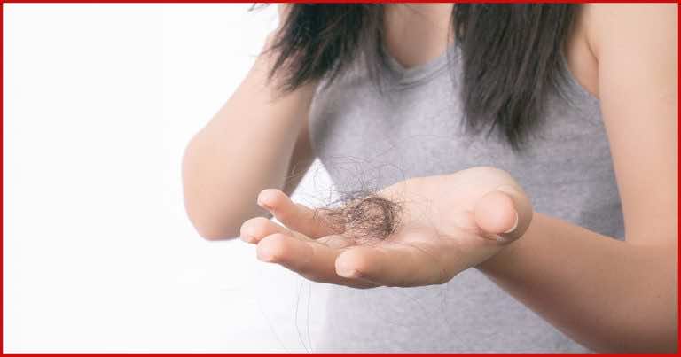 Dlaczego łysieję i jak to zatrzymać?