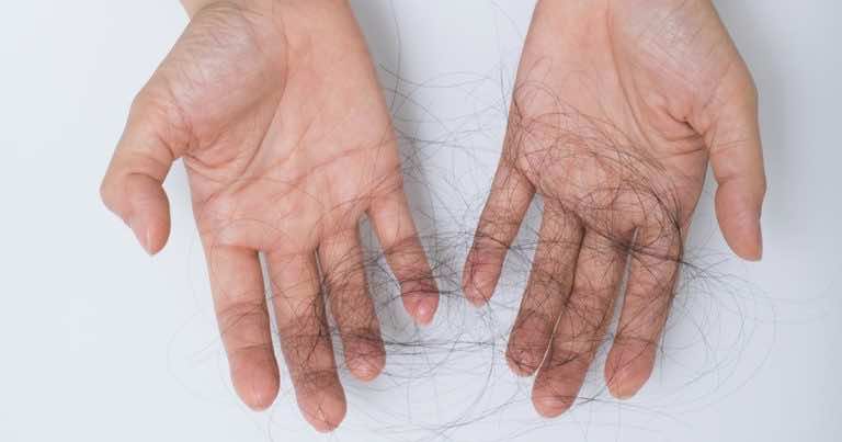 Skuteczne sposoby na nadmierne wypadanie włosów