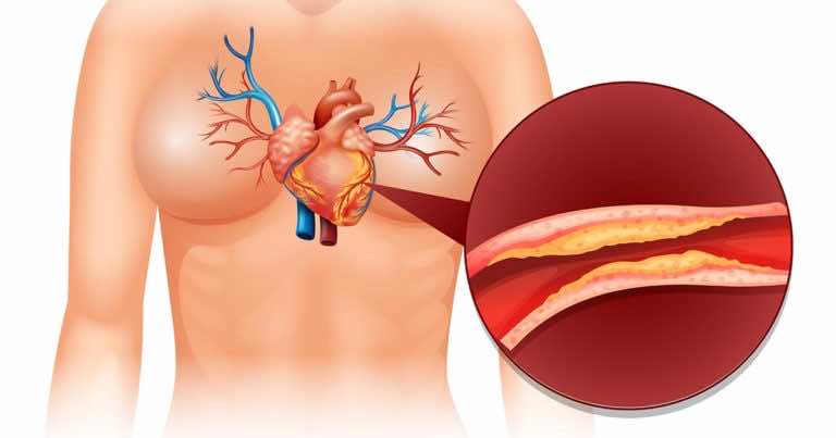 Dbasz o serce? Tego nie jedz!