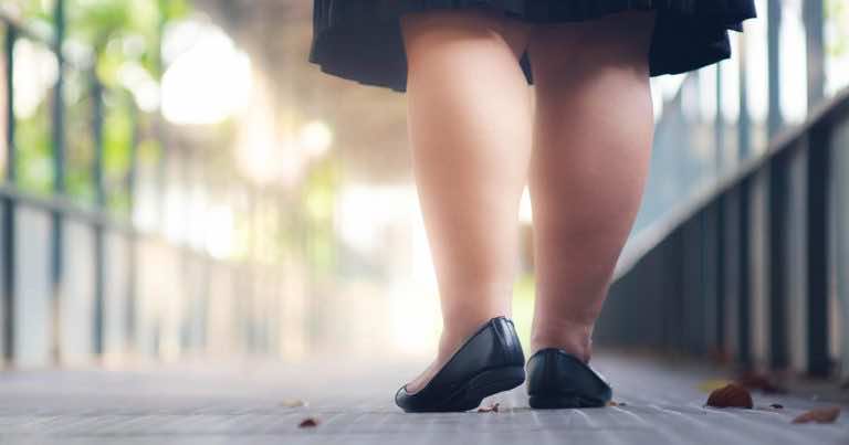 Masz grube nogi? To wcale nie musi być otyłość!